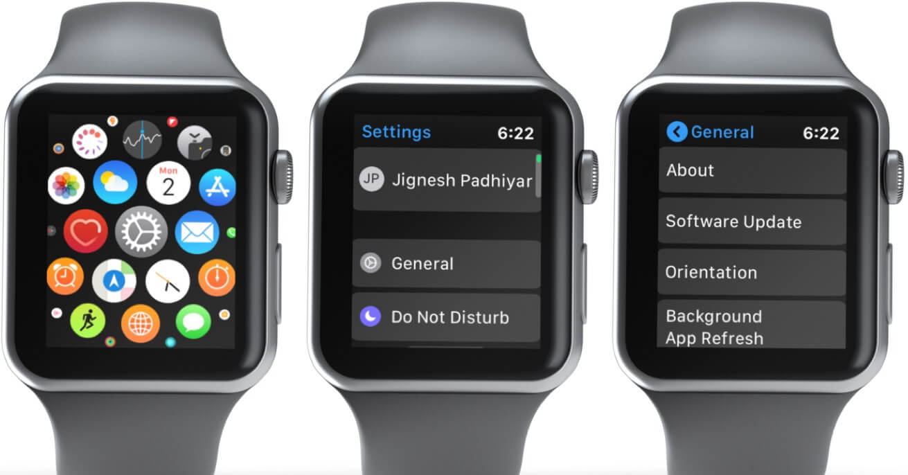 Cài đặt gọi điện trên đồng hồ Apple Watch bằng danh sách yêu thích